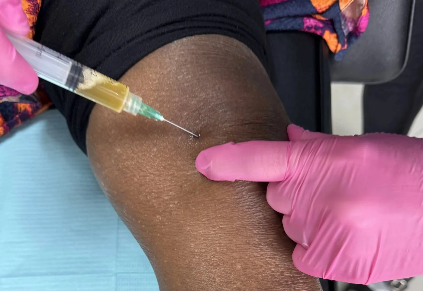 Close-up of plasma being injected into a knee with the clinician's gloved finger marking the injection site